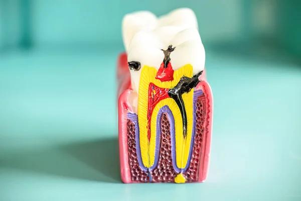 Root Canal Treatment for Lasting Relief and Better Oral Health